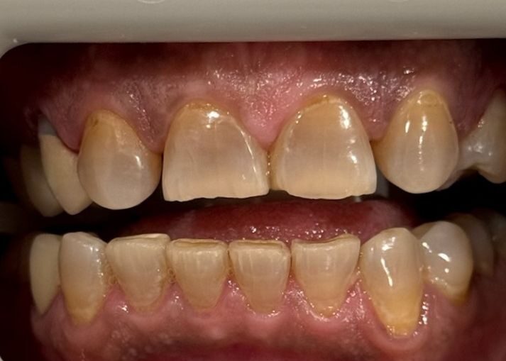 Smile Gallery. Dentist in Edmond, OK. Dr. Mehreen Khan. Smile Lounge of Edmond