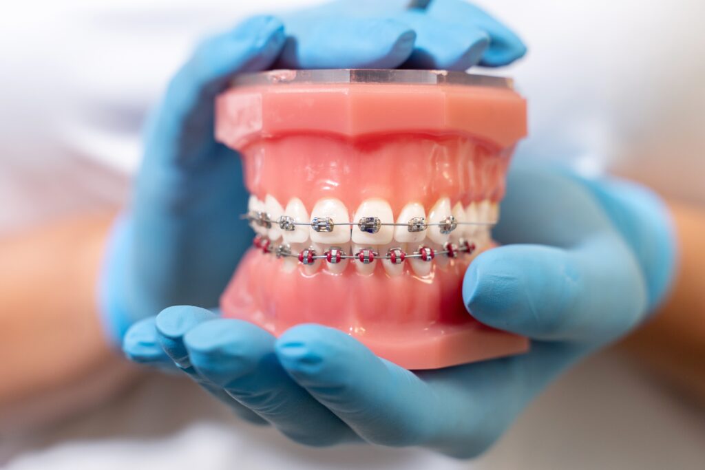 Dental Bonding Edmond